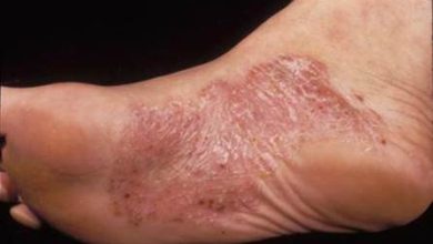 الأمراض-الجلدية-الأكثر-شيوعاً…الأسباب-والعلاج