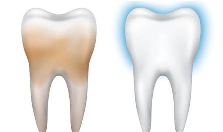 لإزالة-البقع-الصفراء-من-الأسنان.-اليكم-هذه-العلاجات-المنزلية